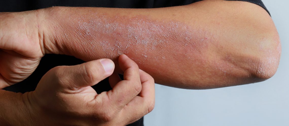 doenças psicossomáticas